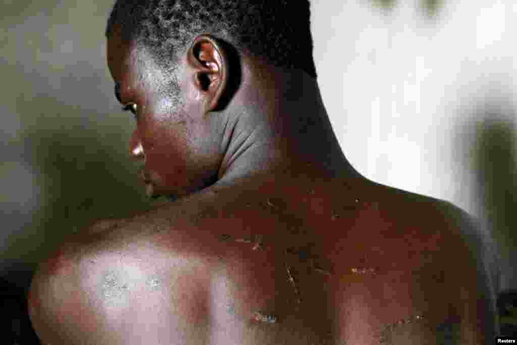 Zongo Meda, un fermier de cacao de 21 ans, montre les blessures dans son dos après avoir été battu par quelqu'un qu'il dit être un agent de SODEFOR, l'agence de direction de la forêt, à Guiglo, Côte d'Ivoire, le 22 mai 2016. Lire la suite ici. 