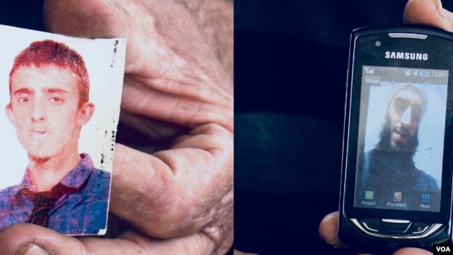 FotografitÃ« e Agon Misinit para dhe pas shkuarjes ne Siri