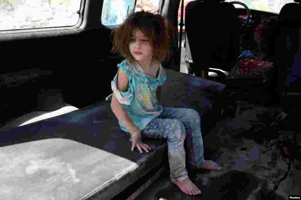 An injured girl sits in a vehicle after surviving double airstrikes on the rebel held Bab al-Nairab neighborhood of Aleppo, Aug. 27, 2016.