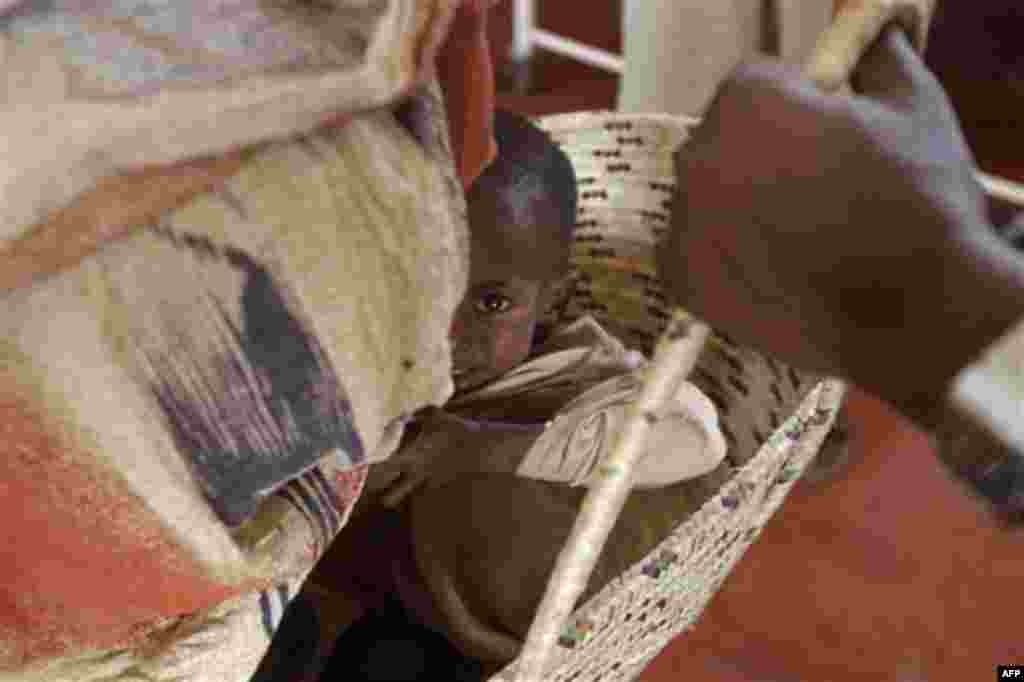 A unidentified child reacts as a nurse weighs him at the International Rescue Committee, IRC, clinic in the town of Dadaab, Kenya, Friday, July 29, 2011. The hospital is just one of three treating Somalis refugees in Dadaab camp. Most of the children are