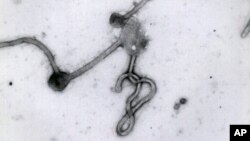 An undated photo made available by the Antwerp Institute of Tropical Medicine in Antwerp, Belgium, shows the Ebola virus viewed through an electron microscope. 