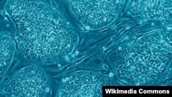 FILE - This file image shows embryonic stem cells.