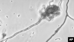 This photo made available by the Centers for Disease Control and Prevention shows a branch of the fungus Aspergillus fumigatus blamed for causing a meningitis outbreak.
