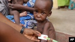 FILE - A doctor attends to a malnourished child at a refugee camp in Yola, Nigeria. The number of people worldwide in need of humanitarian assistance has soared to a record-breaking 130 million, U.N. figures show.