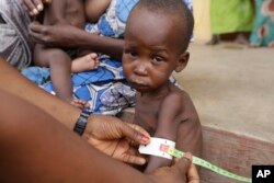 FILE - A doctor attends to a malnourished child at a refugee camp in Yola, Nigeria. Doctors Without Borders says nearly 200 refugees from Boko Haram have died of starvation and dehydration in the city of Bama in the past month.