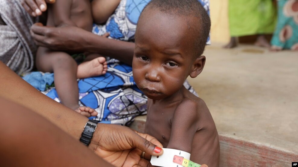 FILE - A doctor attends to a malnourished child at a refugee camp in Yola, Nigeria. Doctors Without Borders says nearly 200 refugees from Boko Haram have died of starvation and dehydration in the city of Bama in the past month. 