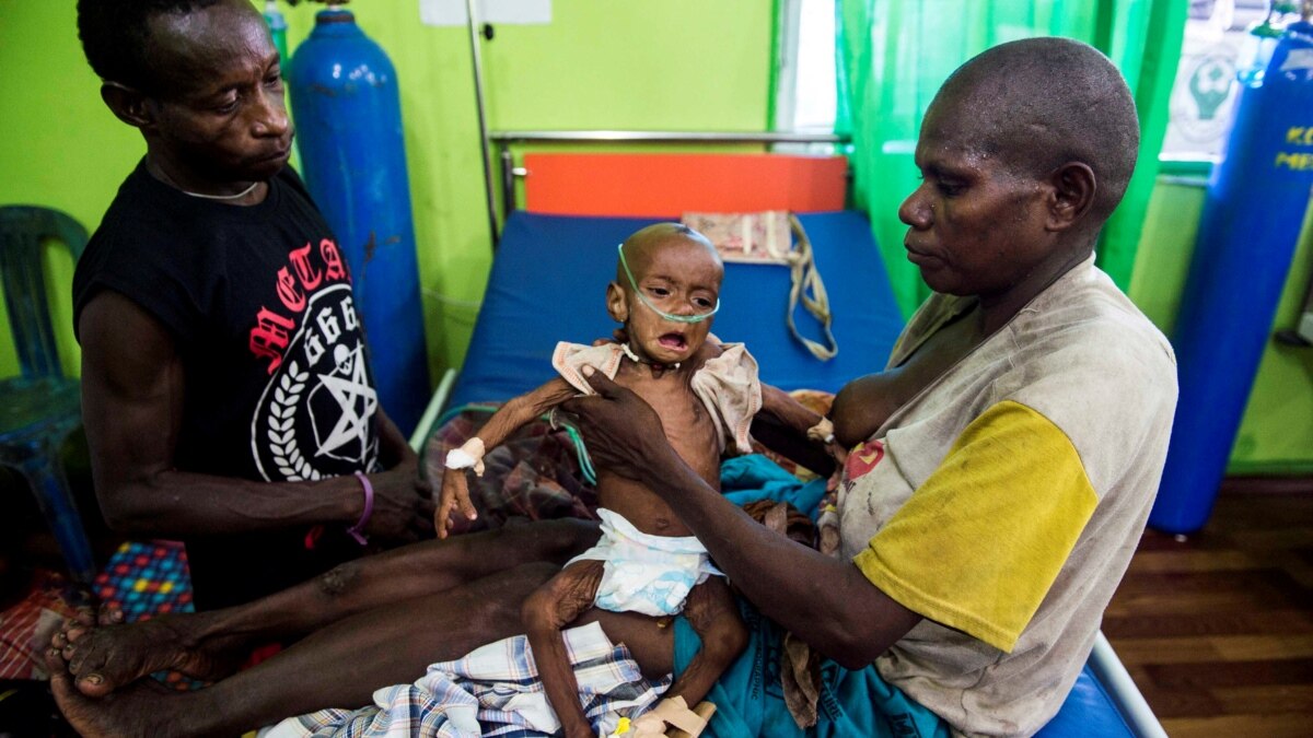 Papua Health Crisis Prompts International Scrutiny, Internal Review