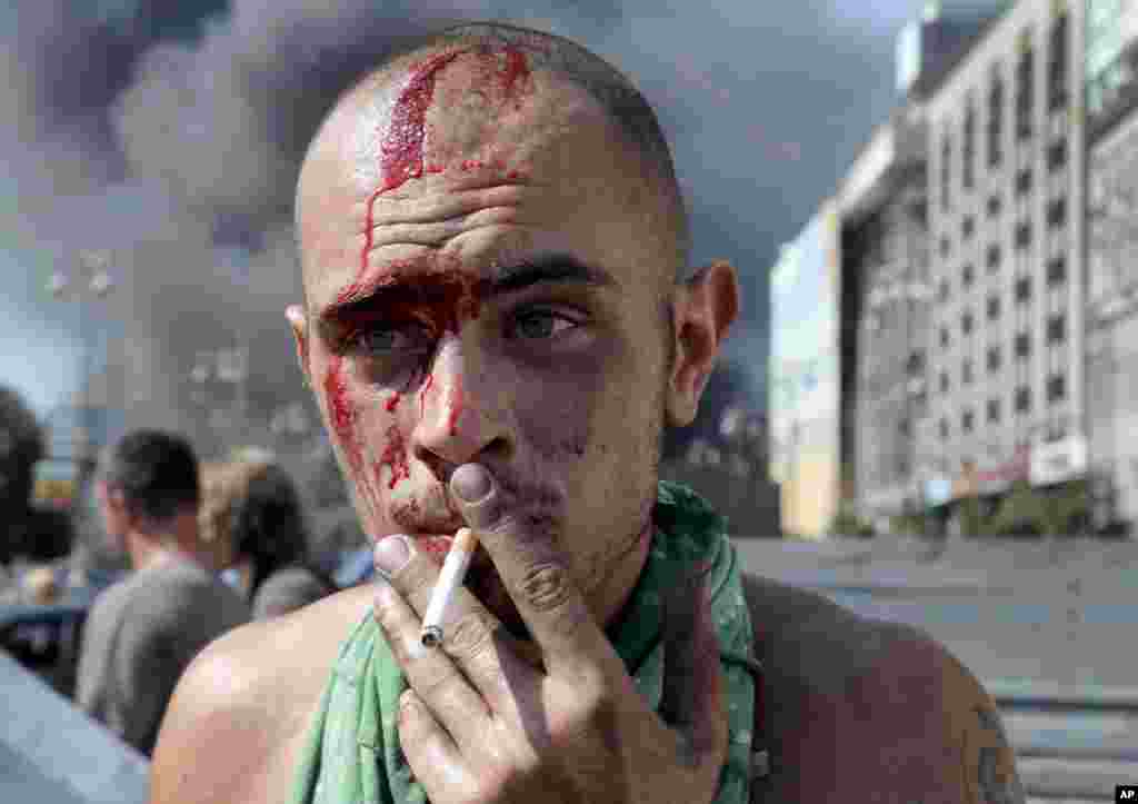 An activist smokes a cigarette after clashes with a special forces police battalion in Independence Square, Kyiv, Ukraine, Aug. 7, 2014.