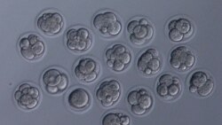 Mouse sperm cells that were freeze-dried, stored in a sealed capsule and preserved on the orbiting International Space Station were injected into unfertilized egg cells in a laboratory, as seen in this undated handout photo. (Teruhiko Wakayama, University of Yamanashi/Handout via REUTERS)