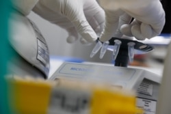 Penelitian sampel untuk mengembangkan vaksin COVID-19 di laboratorium perusahaan bioteknologi, BIOCAD, di Saint Petersburg, Rusia, 11 Juni 2020. (Foto: Reuters)