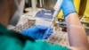 Sedam preminulih, 546 novih slučajeva koronavirusa u Crnoj Gori