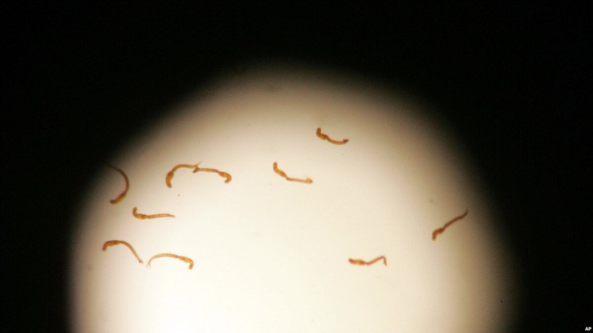 New 'Snail Fever' Treatment Suggested for Kids Under 5