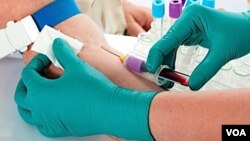 El examen llamado ANESA no detecta anticuerpos en la sangre, así que no se puede utilizar para pruebas de VIH o Hepatitis C.