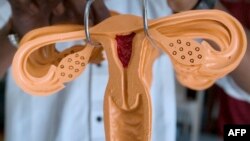 FILE - A life-sized rubber model of a uterus is used as a health educational tool at a workshop in India, Nov. 6, 2008. The first uterus transplant at a U.S. hospital failed due to a “sudden complication.”