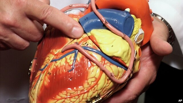 Quiz - Des scientifiques créent le premier modèle de cœur humain imprimé en 3D pleine grandeur