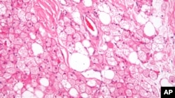 FILE - Brown fat cells are seen in the body.