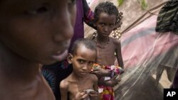 In this Saturday, Aug.13, 2011 photo released by the UNHCR severely malnourished children look on at the Al-Adala internally displaced people settlement in Mogadishu, Somalia