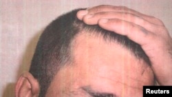 A detainee shows his scalp in an undated photo from Iraq's Abu Ghraib prison, among 198 images released in a Freedom of Information Act lawsuit against the U.S. Department of Defense in Washington, D.C., Feb. 5, 2016.