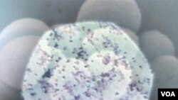 Medicina: Bakterije postaju otpornije zahvaljujući antibioticima