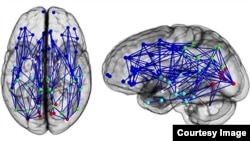 Neural map of a typical male brain. (Photo courtesy of National Academy of Sciences)