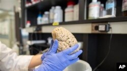 FILE- Researcher holds human brain in laboratory at Northwestern University's cognitive neurology and Alzheimer's disease center, Chicago, July 29, 2013.