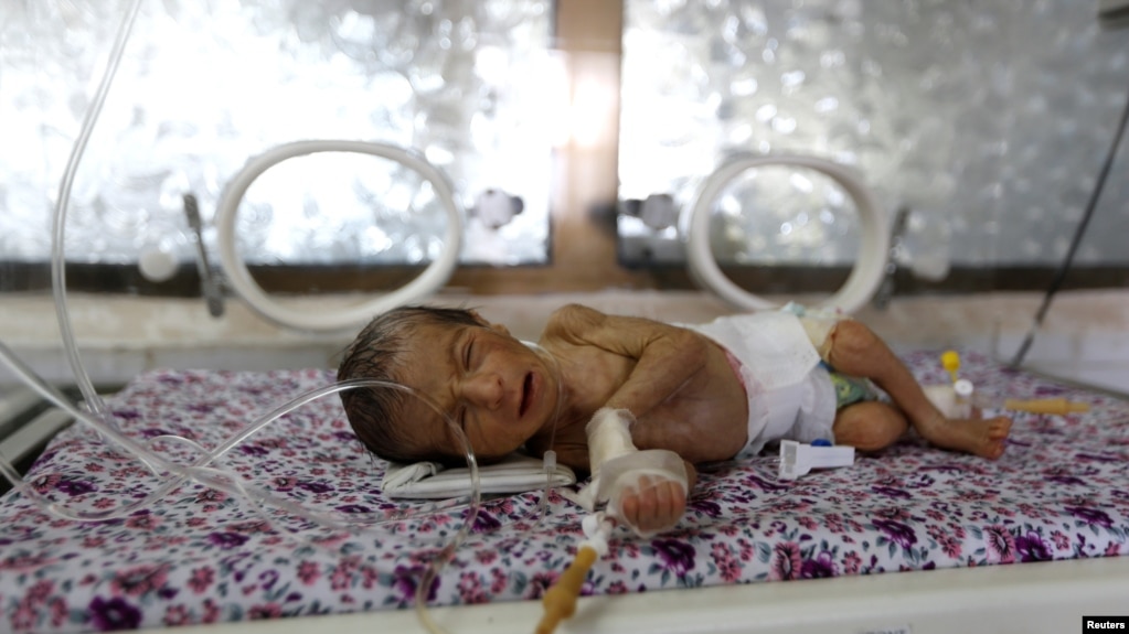 A premature baby lies in an incubator at the child care unit of a hospital in Sana'a, Yemen January 16, 2018.
