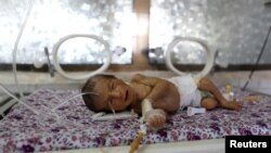 A premature baby lies in an incubator at the child care unit of a hospital in Sana'a, Yemen January 16, 2018.