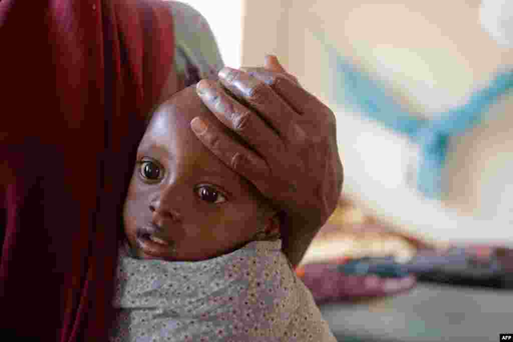 July 23: A woman holds her child at a ocal hospital where children receive treatment for malnutrition at the border town of Dadaab, Kenya. The drought in the Horn of Africa and the famine in Somalia has left more than two million children at risk of star