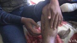 Wounded Syrian Refugees Strain Jordan's Health Services