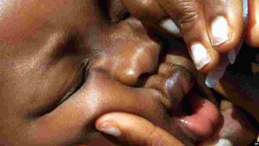 A baby receives a polio vaccine in Nigeria