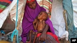 FILE - A displaced Somali mother comforts her malnourished child in their makeshift shelter at a camp in the Garasbaley area on the outskirts of Mogadishu, Somalia, March 28, 2017.