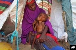FILE - A displaced Somali mother comforts her malnourished child in their makeshift shelter at a camp in the Garasbaley area on the outskirts of Mogadishu, Somalia, March 28, 2017.