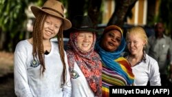 This image courtesy of the Milliyet Daily shows albino women posing on May 5, 2014, in Dar es Salaam. The Tanzanian government has taken some steps in the wake of the killing spree, opening shelters for albino children. AFP PHOTO/MILLIYET DAILY HANDOUT/BUNYAMIN AYGUN 