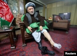 FILE - Ahmad Ishchi, who is reported to have been beaten and detained on order of Afghanistan's Vice President, Abdul Rashid Dostum, displays an injury on his leg during an interview at his home in Kabul, Afghanistan, Dec. 13, 2016.