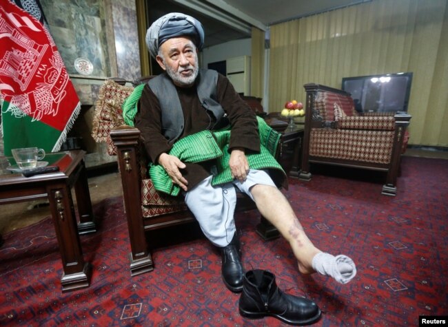 FILE - Ahmad Ishchi, who is reported to have been beaten and detained on order of Afghanistan's Vice President, Abdul Rashid Dostum, displays an injury on his leg during an interview at his home in Kabul, Afghanistan, Dec. 13, 2016.