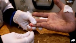 乌克兰医生为一位吸毒者做HIV艾滋病毒检验
