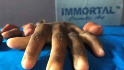 A prosthetic hand is pictured at Immortal Cosmetic Art company, in Uyo, Nigeria January 7, 2020.