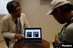 Dr. Lin Ming-teng, head of the psychiatry department at Taipei Veterans General Hospital, shows X-ray images explaining the difference between a normal brain (L) and Chen Hong-zhi's brain during an appointment at the hospital, in Hsinchu, Taiwan, July 31,