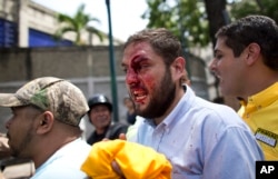 Opposition lawmaker Juan Requesens, center, is escorted out by his colleagues after he was hit in the forehead by alleged government supporters as he protested with a group of fellow lawmakers outside of the Ombudsman's offices in Caracas, Venezuela, Apri