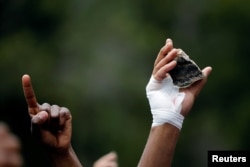 A student with a bandaged hand holds a rock during clashes with police over high tuition fees at Johannesburg's University of the Witwatersrand, South Africa, October 4, 2016.