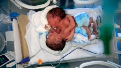 Newborn conjoined twins lie in an incubator at the child intensive care unit of al-Sabeen hospital in Yemen's capital Sanaa. The boys, born in war-ravaged Yemen, are in critical condition and in need of treatment abroad, according to the hospital.