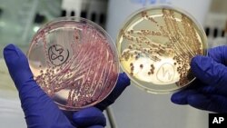 ພະນັກງານຄົນນຶ່ງ ພວມຖືກັບບັນຈຸເຊື້ອບັກເຕເຣຍ EHEC (bacterium Escherichia coli.) ທີ່ຫ້ອງແລັບ ມະຫາວິທະຍາໄລ ທີ່ເມືອງ Hamburg ໃນພາກເໜືອເຢຍຣະມັນ (2 ມິຖຸນາ 2011)