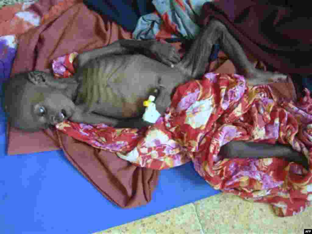 Abdihakin Omar 3, a malnourished child from southern Somalia lies on the floor in Banadir hospital in Mogadishu, Somalia, Thursday, July 21, 2011. Somalia's 20-year-old civil war is partly to blame for turning the drought in the Horn of Africa into a fami