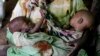In Sub-Saharan Africa, 1 in 5 Twins Dies Before Age 5