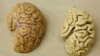Nghiên cứu mở ra hy vọng khôi phục trí nhớ cho người mắc bệnh Alzheimer