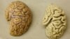 Mariyuana Kemungkinan Bermanfaat untuk Pasien Alzheimer