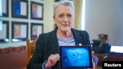 Berit Reiss-Andersen, chair of the Nobel Committee, shows a displayed image with the logo of the World Food Program, humanitarian organization which has been announced as the Nobel Peace Prize laureate, in Oslo, Norway October 9, 2020.