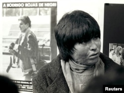 FILE - Carmen Gloria Quintana is seen near her home in Santiago in July of 1987. Quintana, then 18 years old, suffered burns over 65 percent of her body on July 2, 1986. A poster behind her shows photographer Rodrigo Rojas.