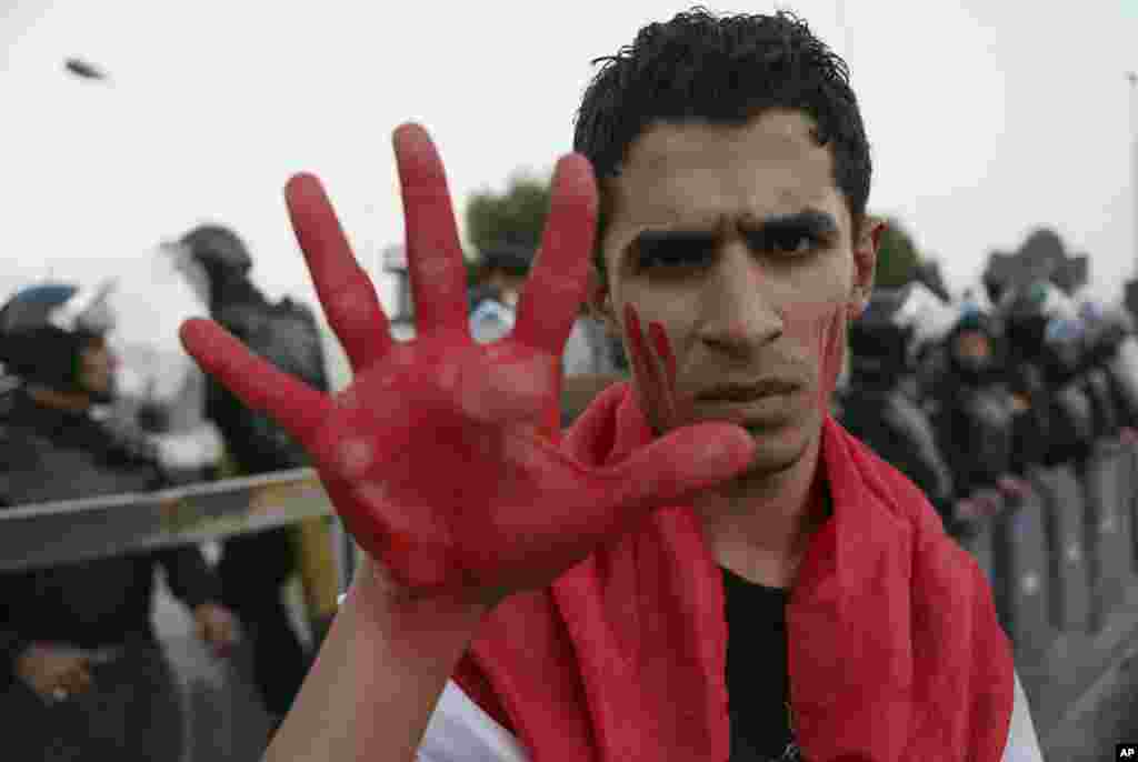 A protester displays his painted hand as a sign of anger, during a demonstration calling for the withdrawal of Turkish troops from northern Iraq, in Basra, 340 miles (550 kilometers) southeast of Baghdad, Iraq. Turkey has had troops near Mosul since last year but the arrival of additional troops last week sparked an uproar.
