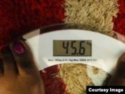 Marlene Gadzirayi lost weight while undergoing chemotherapy and radiotherapy treatments.(Courtesy Image)